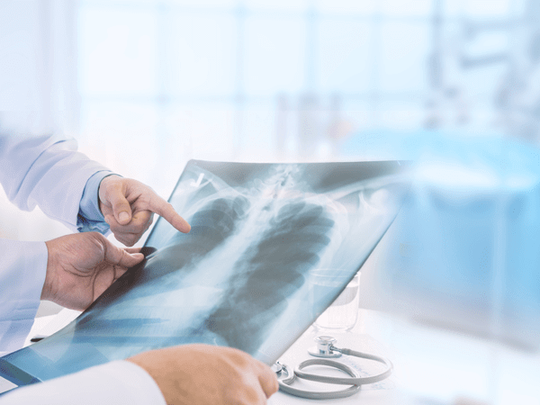 Πνεύμονες και Διατροφή: Ποιος είναι ο ρόλος των αντιοξειδωτικών στην πνευμονική λειτουργία;